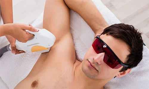 Lazer Epilasyon Görseli